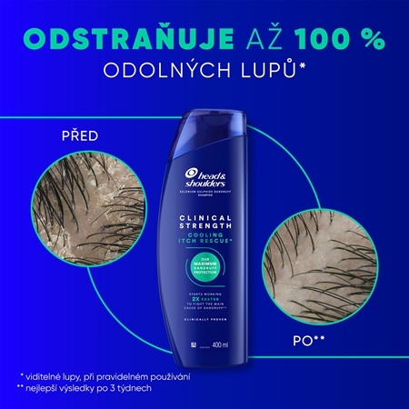 Head & Shoulders Cooling Itch Rescue šampon proti lupům a svědění