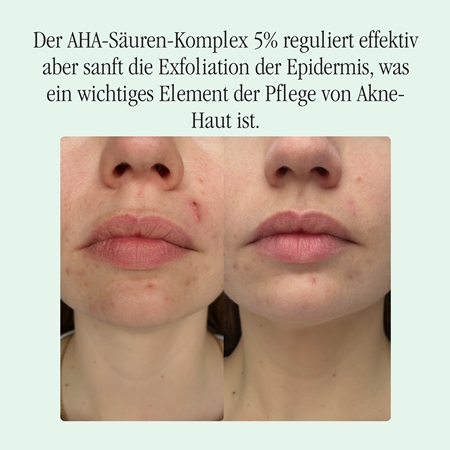 Health Labs Care Solve On Serum mit AHA