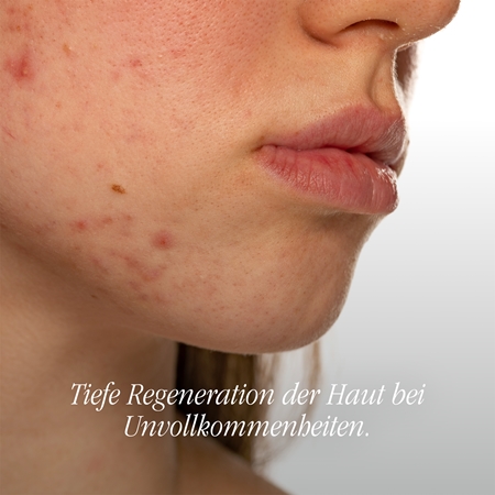 Health Labs Care Solve On Gesichtscreme mit Ceramiden
