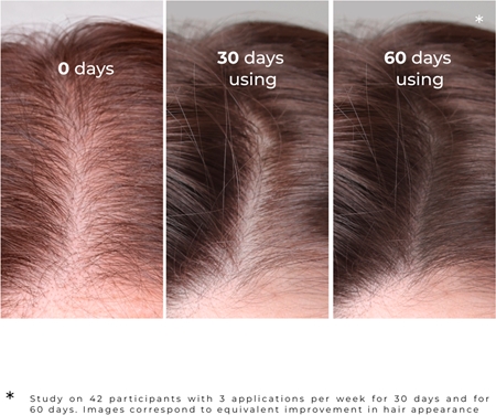 Elfa Pharm Intensive Cosmetic Intensive Hair Therapy Burdock Serum бальзам проти випадіння волосся з активаторем росту