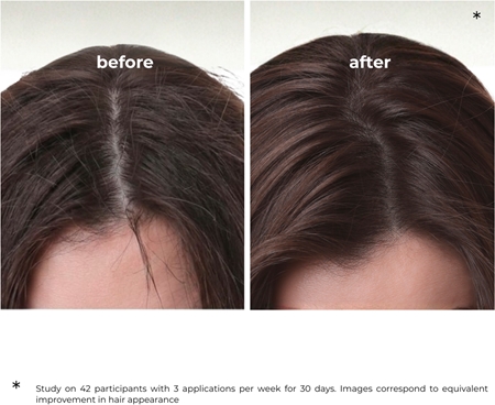 Elfa Pharm Intensive Cosmetic Intensive Hair Therapy Burdock Shampoo шампунь проти випадіння волосся з активаторем росту