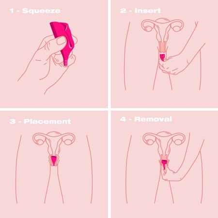 Intimina Lily Cup A Menstruationstasse