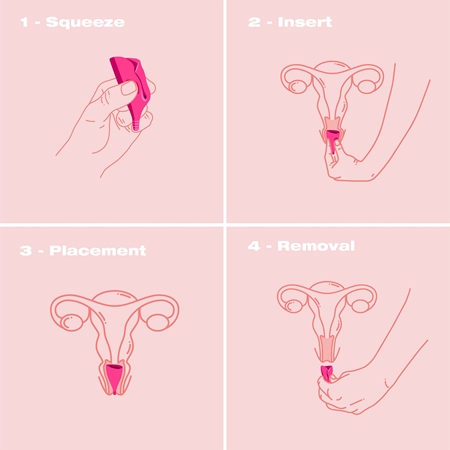 Intimina Lily Cup B Menstruationstasse