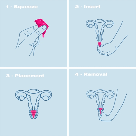 Intimina Lily Cup Compact B Menstrual Cup