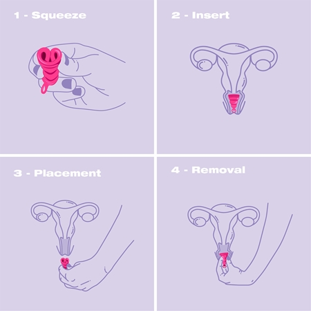 Intimina Lily Cup One Menstruationstasse