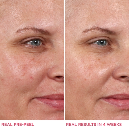 IT Cosmetics Hello Results pleťový peeling s kyselinou glykolovou