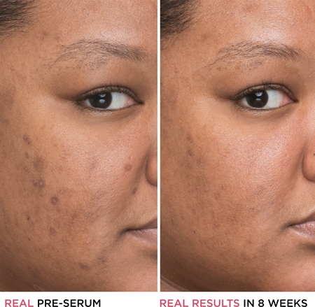 IT Cosmetics Bye Bye Dark Spots sérum corretor clareador antimanchas com niacinamida