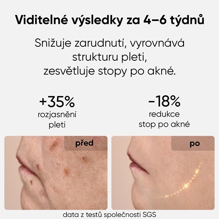 JOVS LED Mask obličejová LED maska