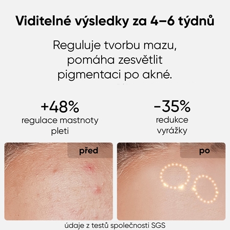 JOVS LED Mask obličejová LED maska