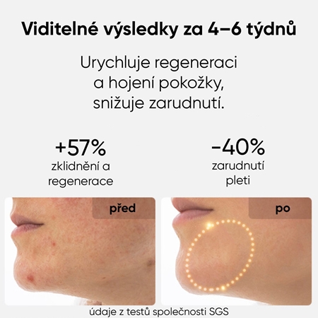 JOVS LED Mask obličejová LED maska