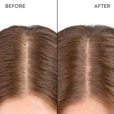 KERASILK Specialists Moisturizing Scalp Drops dråber Til tør og sensitiv hovedbund