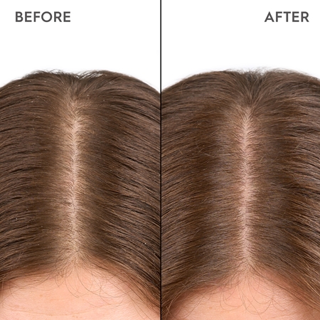 KERASILK Specialists Moisturizing Scalp Drops Drops for dry and sensitive scalp