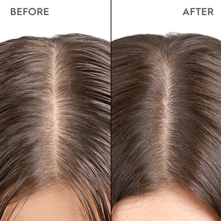 KERASILK Specialists Exfoliating Scalp & Hair Treatment cuidado pré-champô com efeito esfoliante