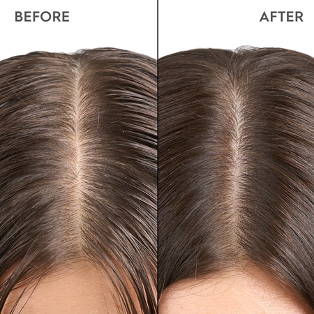 KERASILK Specialists Exfoliating Scalp & Hair Treatment Feuchtigkeitspflege zur Nutzuung vor der Haarwäsche mit Peeling-Effekt