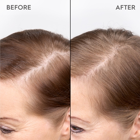KERASILK Specialists Redensifying Scalp Serum Hårserum Til at gendanne hårets fylde
