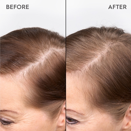KERASILK Specialists Redensifying Scalp Serum plaukų serumas plaukų tankumui atkurti