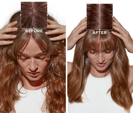 Kérastase Symbiose Fondant Apaisant Essentiel Conditioner für Haare und Kopfhaut