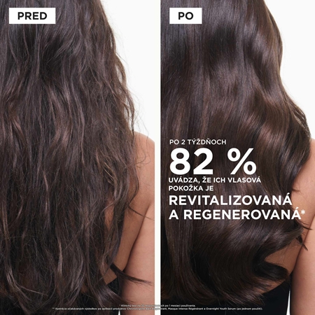 Kérastase Chronologiste Longevity Potion sérum na vlasovú pokožku