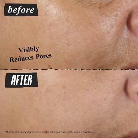 Kiehl's Rare Earth Deep Pore Cleansing Mask Tiefenreinigende Maske zur Reduzierung der Poren