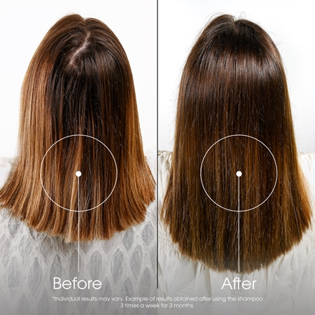 Klorane Quinine Anti-Hair Loss Shampoo Energising Shampoo against hair loss