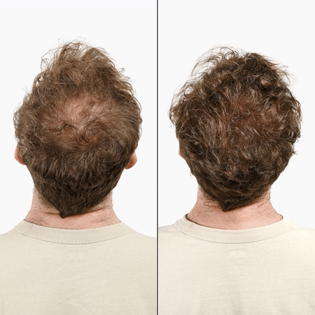 Klorane Quinine & Edelweiss Bio stärkendes Shampoo gegen Haarausfall