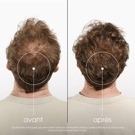 Klorane Quinine Anti-Hair Loss Shampoo shampoing fortifiant anti-chute