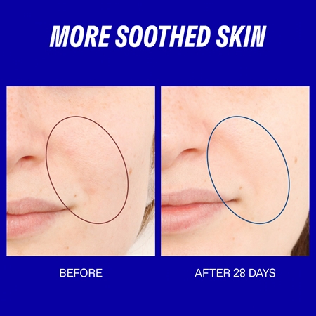 Korres Smart Yoghurt™ Probiotic Super Serum Moisturizing Face Serum with probiotics