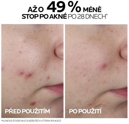 La Roche-Posay Effaclar koncentrované sérum pro problematickou pleť, akné