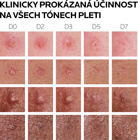 La Roche-Posay Effaclar DUO (+M) korekční obnovující péče proti nedokonalostem pleti a stopám po akné