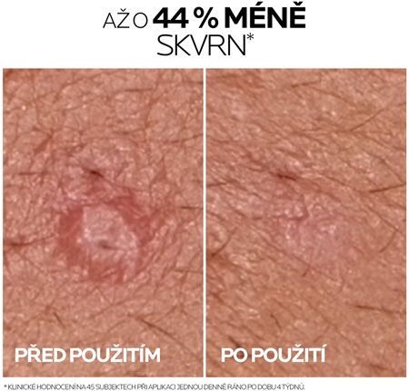 La Roche-Posay Effaclar DUO (+M) korekční obnovující péče proti nedokonalostem pleti a stopám po akné