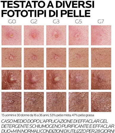 La Roche-Posay Effaclar DUO (+M) trattamento correttore rigenerante contro le imperfezioni della pelle e le tracce di acne
