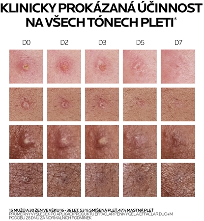 La Roche-Posay Effaclar DUO (+M) korekční obnovující péče proti nedokonalostem pleti a stopám po akné