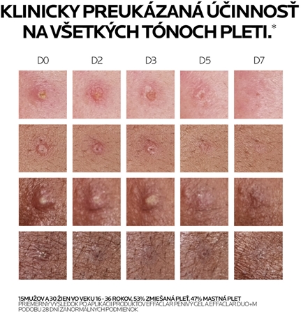 La Roche-Posay Effaclar DUO (+M) korekčná obnovujúca starostlivosť proti nedokonalostiam pleti a stopám po akné