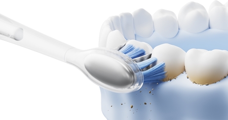 Laifen ProS Pro Plaque Removal toothbrush replacement heads