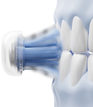 Laifen ProS Pro Plaque Removal toothbrush replacement heads