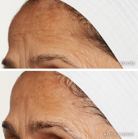 LANCER NOURISH REHYDRATION MASK Moisturising Nourishing Mask