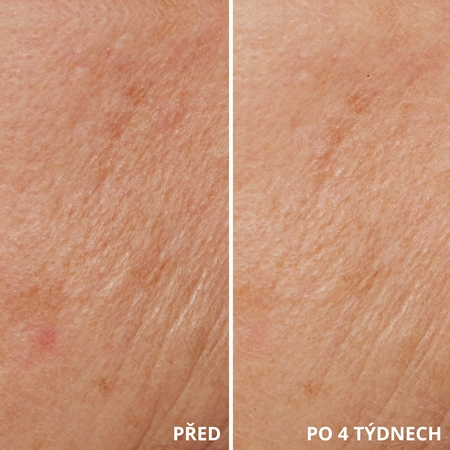 LANCER TRIPLE PEPTIDE DROPS omlazující sérum s peptidy