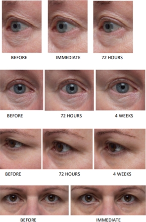 LANCER GRAVITY DEFYING Eye Cream crème raffermissante yeux effet lifting