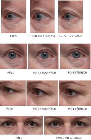 LANCER GRAVITY DEFYING Eye Cream zpevňující oční krém s liftingovým efektem