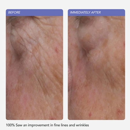 LANCER Ultra Rich Barrier Cream Moisturizing Cream with Ceramides to strengthen the skin barrier