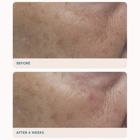 LANCER GRAVITY DARK SPOT CORRECTING SERUM ορός για την αντιμετώπιση των μαύρων κηλίδων