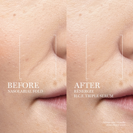 Lancôme Rénergie H.C.F. Triple Serum pleťové sérum
