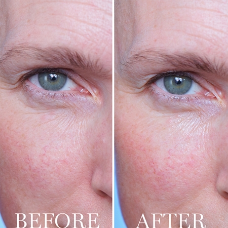 Lancôme Génifique Advanced Eye Cream Crema de ochi pentru reintinerire