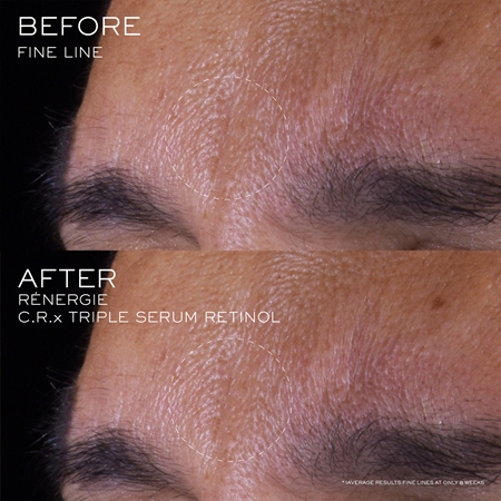 Lancôme Rénergie CRX Triple Serum Retinol pleťové sérum