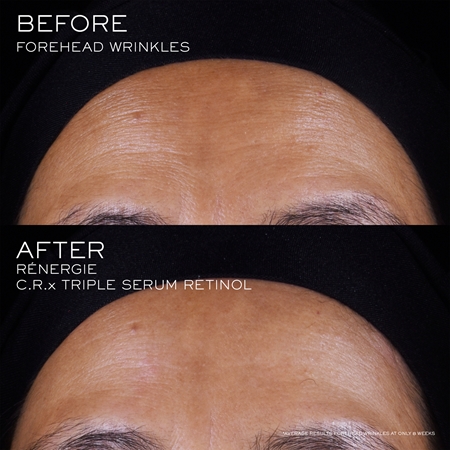 Lancôme Rénergie CRX Triple Serum Retinol pleťové sérum