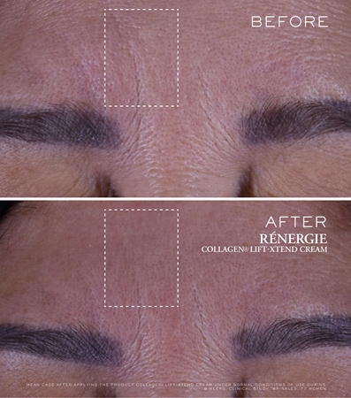 Lancôme Rénergie Collagen+ Lift-Xtend Cream Ansiktskräm Med kollagen