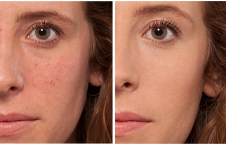L’Oréal Paris True Match Magique Touch rozjasňujúci korektor