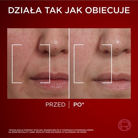 L’Oréal Paris Revitalift Laser krem intensywnie odżywiający do twarzy na dzień
