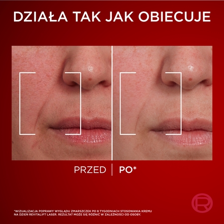 L’Oréal Paris Revitalift Laser krem intensywnie odżywiający do twarzy na dzień