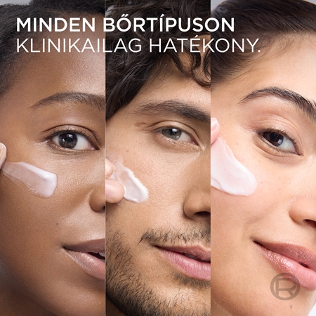 L’Oréal Paris Revitalift Filler feltöltő nappali krém öregedés ellen